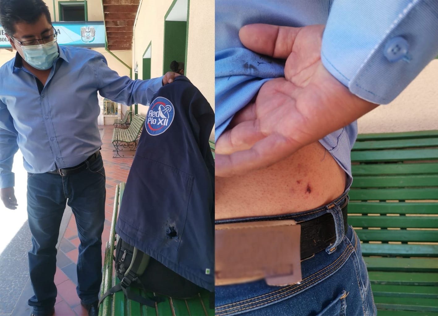 Periodistas golpeados por policías y atacados con juegos de pirotecnia